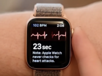 AppleWatch发现作者未确诊的心脏病
